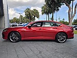 Used 2025 ACURA TLX SH-AWD W/A-SPEC PACKAGE in FT. LAUDERDALE, FLORIDA (Photo 3)